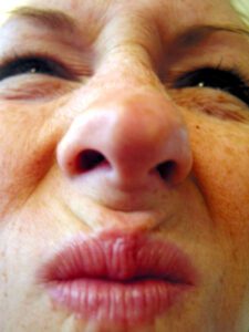 women squishing her nose