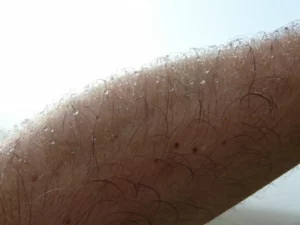 man's hairy arm